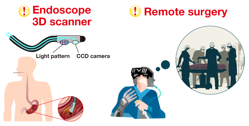 Endoscope 3D scanner Remote surgery